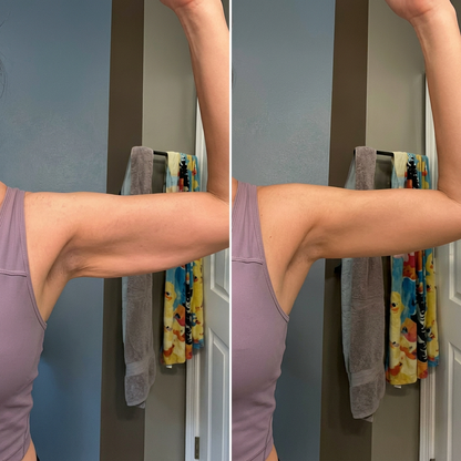 Mangas Armplify -  Para Brazos Más Firmes